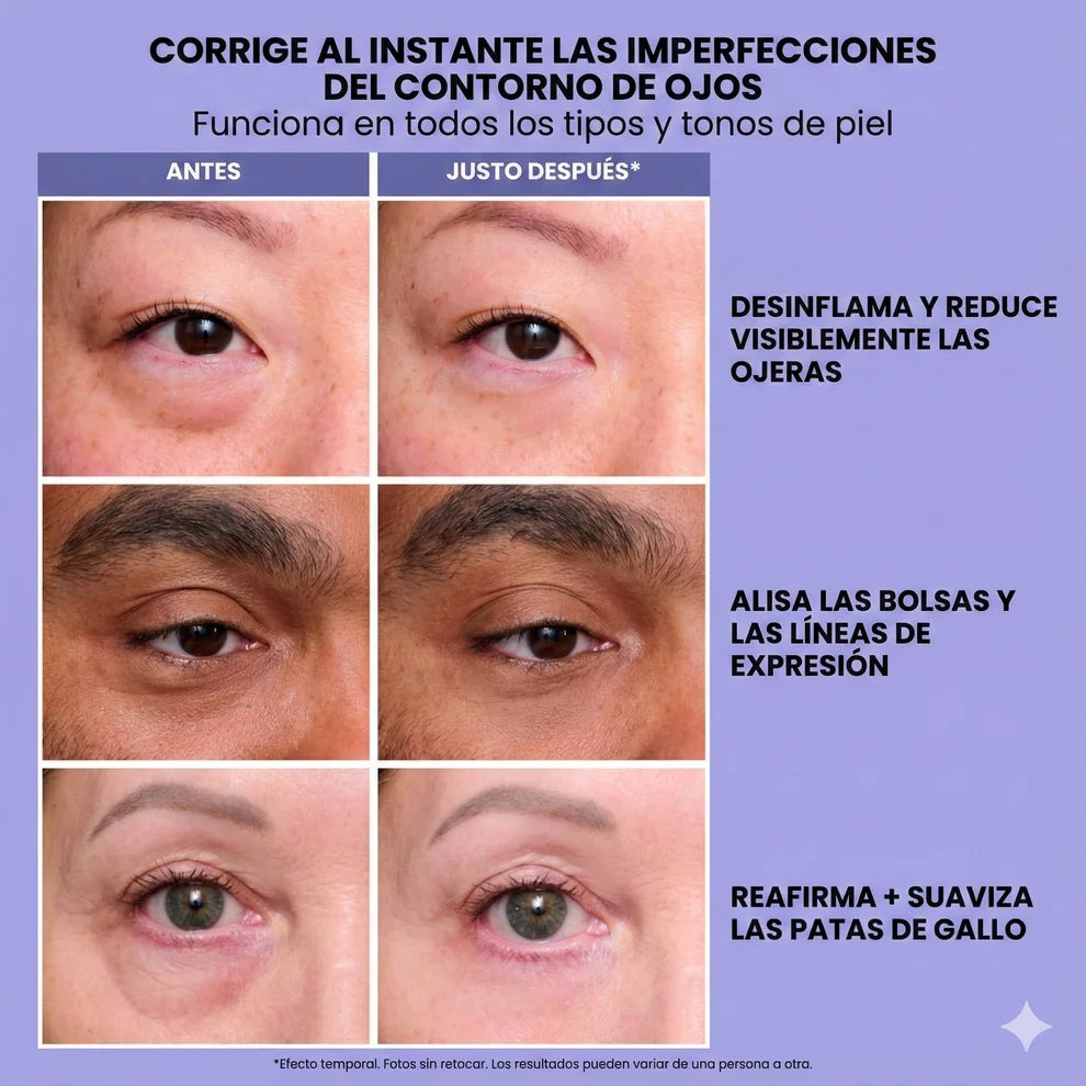 EloviaLiftEye™ – Gel tensor para bolsas y líneas de expresión