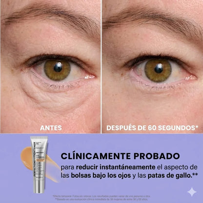 EloviaLiftEye™ – Gel tensor para bolsas y líneas de expresión
