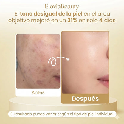 GoldMask — Mascarilla Nocturna Peel-Off de Cúrcuma y Ácido Kójico