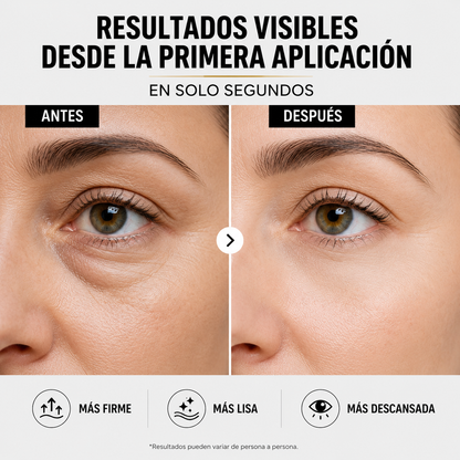LumEye™ — Contorno de Ojos Efecto Tensor